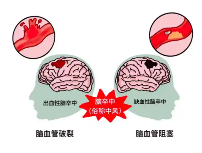 11.webp.png
